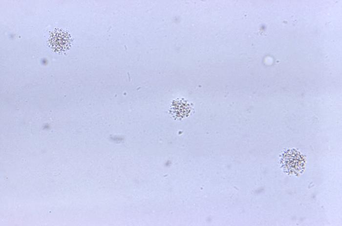 Ureaplasma urealyticum, определение ДНК