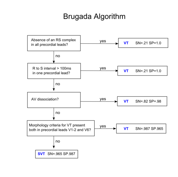 File:De-Brugada algorithm (CardioNetworks ECGpedia).png