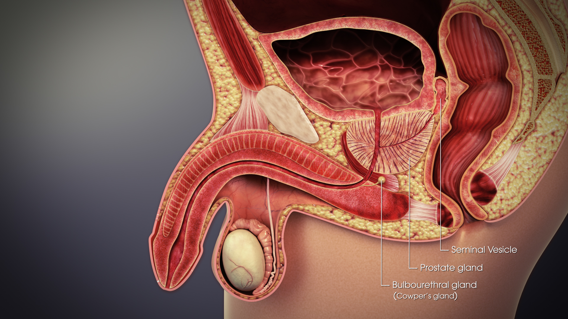 What Is Prostate Cancer?