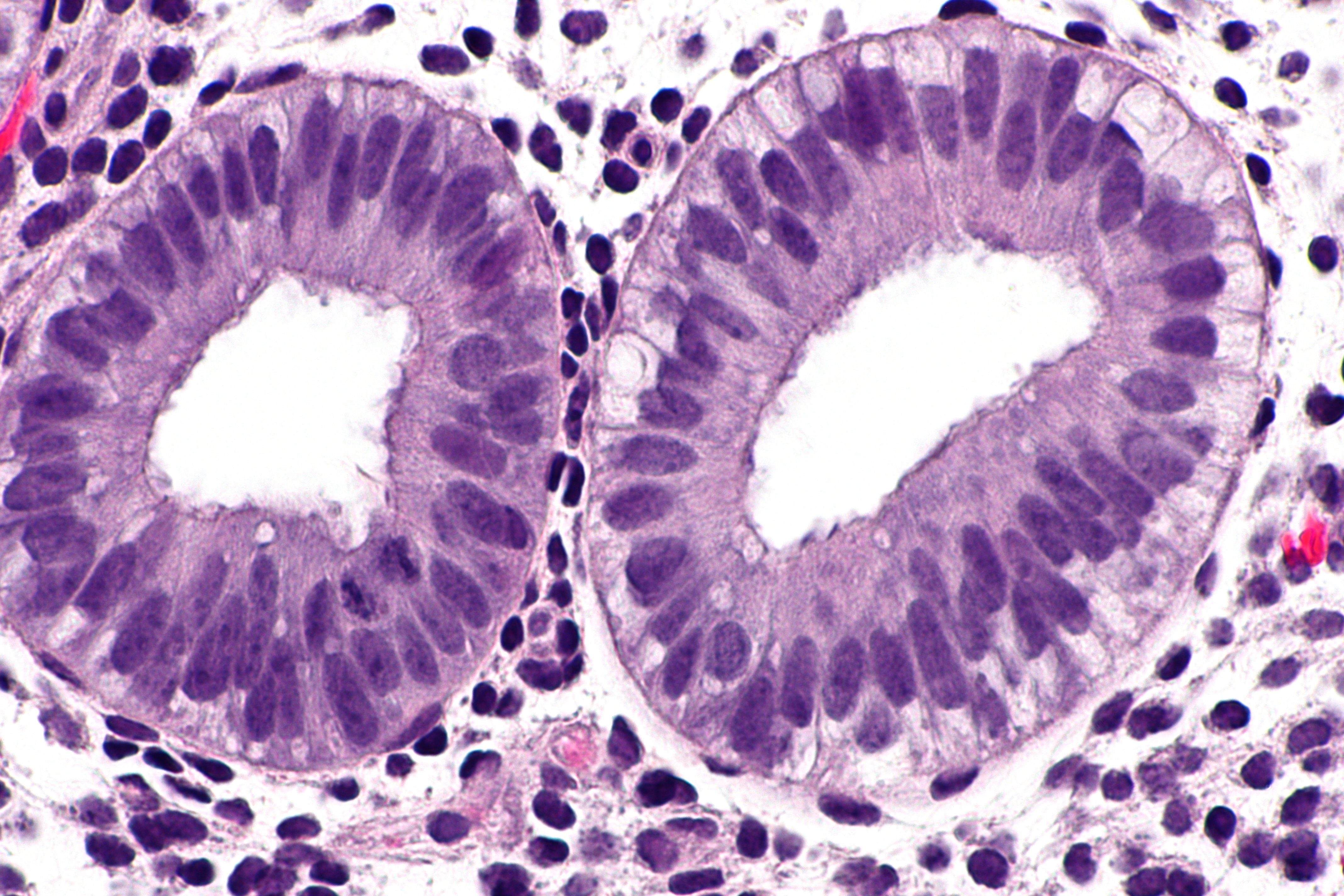 Early secretory phase endometrium -- very high mag.jpg. 