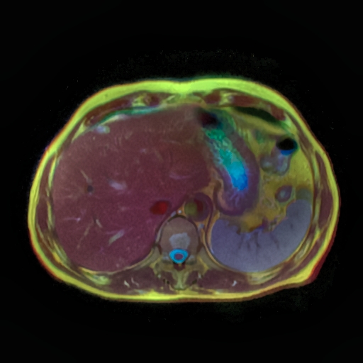 File:Kidney tm Color MRI 11.jpg