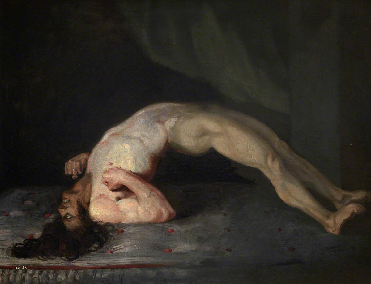Opisthotonus in a patient suffering from tetanus - Painting by Sir Charles Bell - 1809