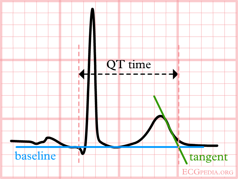 File:De-LastigeQT1 (CardioNetworks ECGpedia).png