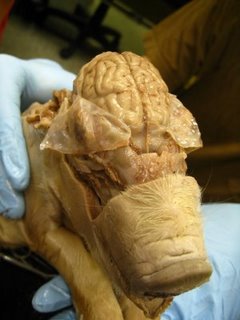 File:Fetal Pig Cerebelum.jpg