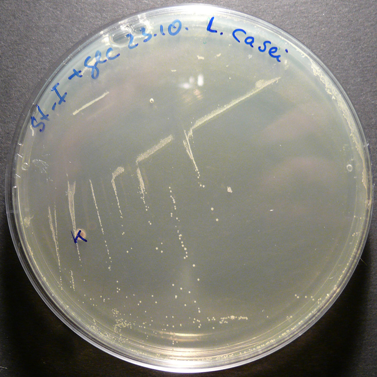 https://upload.wikimedia.org/wikipedia/commons/d/d9/Lactobacillus_casei_1.jpg