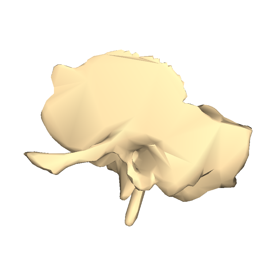 Resultado de imagen para temporal bone