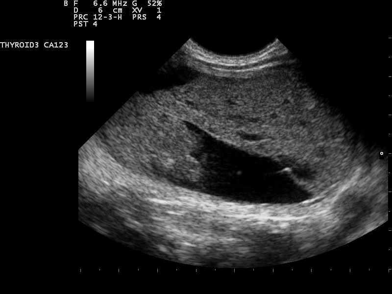 File:Ultrasound Scan ND 0124141638 1428210.png
