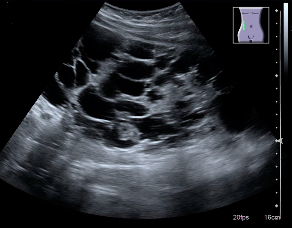 腎臓超音波検査 Renal Ultrasonography: 最新の百科事典、ニュース