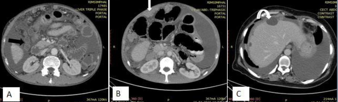 Contrast CT - Wikipedia