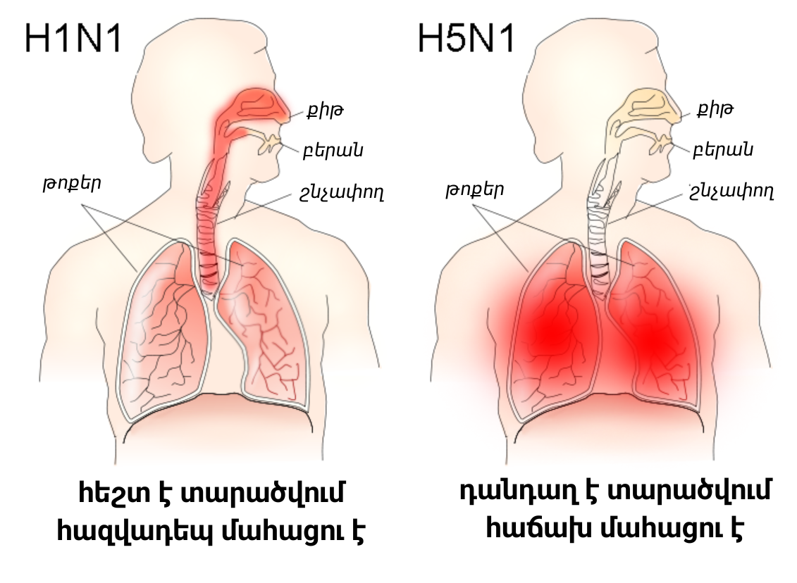 H 1 n 1. Птичий грипп симптомы у людей симптомы. Признаки птичьего гриппа у человека симптомы. Птичий грипп симптомы заражения у людей.