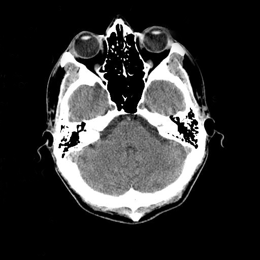 File:Head CT scan.jpg