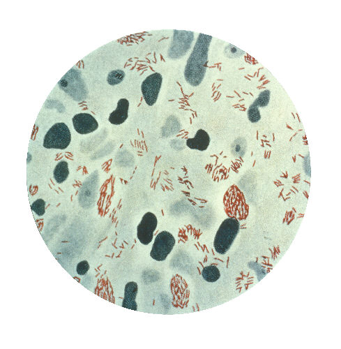 File:Mycobacterium leprae.jpeg