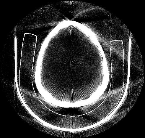 File:Ct skull.jpg