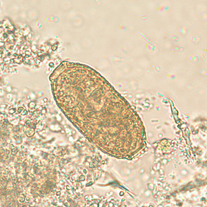 File:Capillaria philippinensis egg (01).jpg