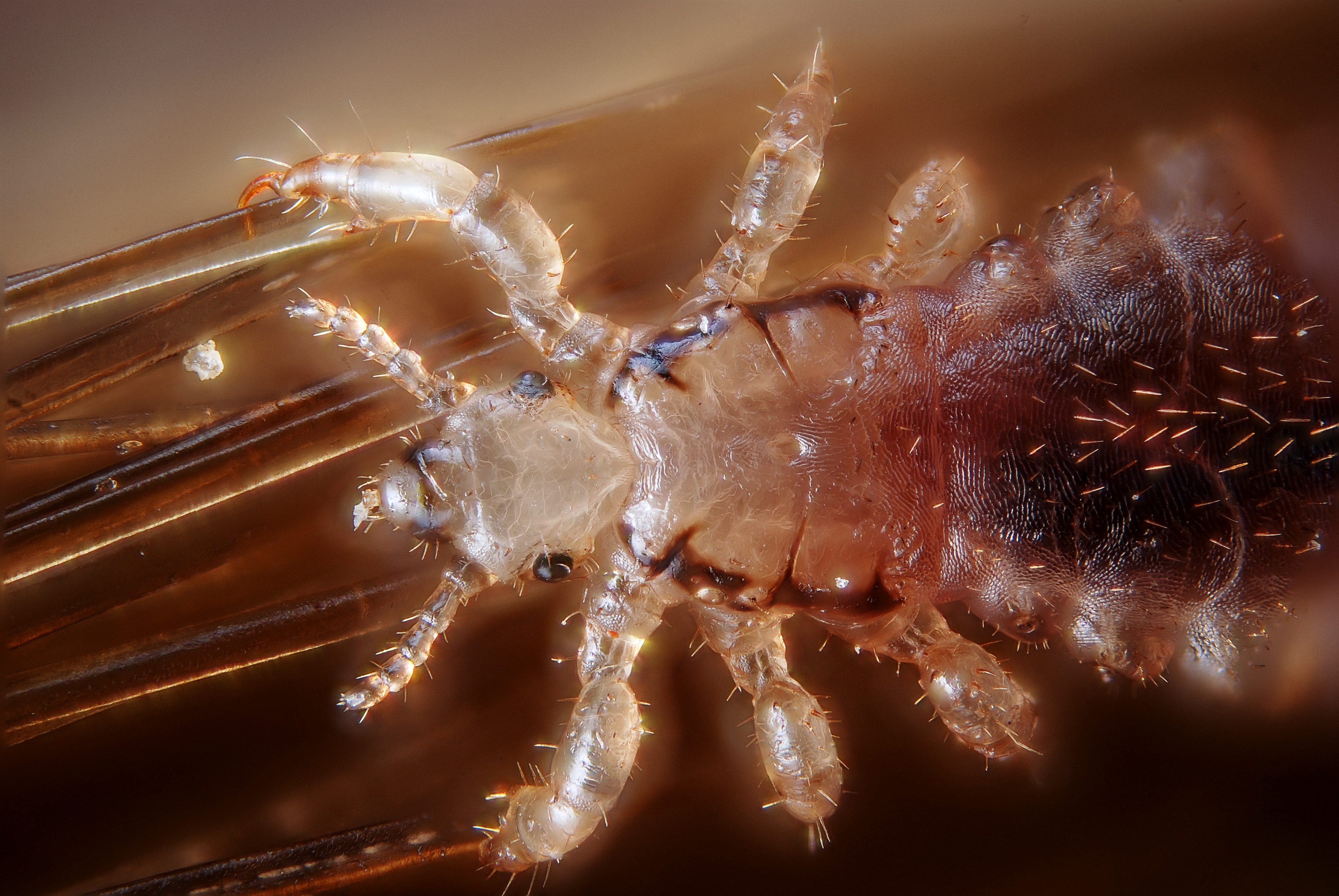 Вши у человека. Головная вошь (Pediculus humanus capitis). Головная вошь - Pediculus capitis.