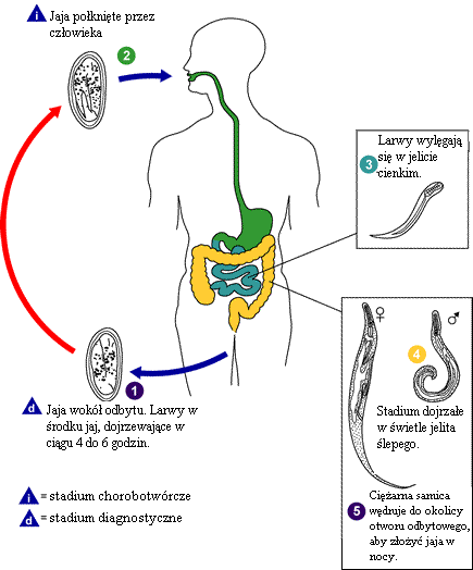 Owsica icd 10