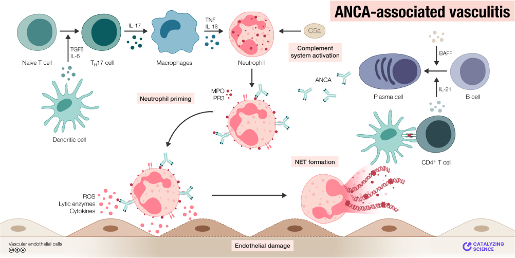 ANCA