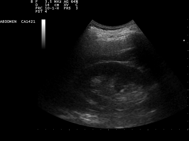 File:Ultrasound Scan ND 0110145312 1506110.png