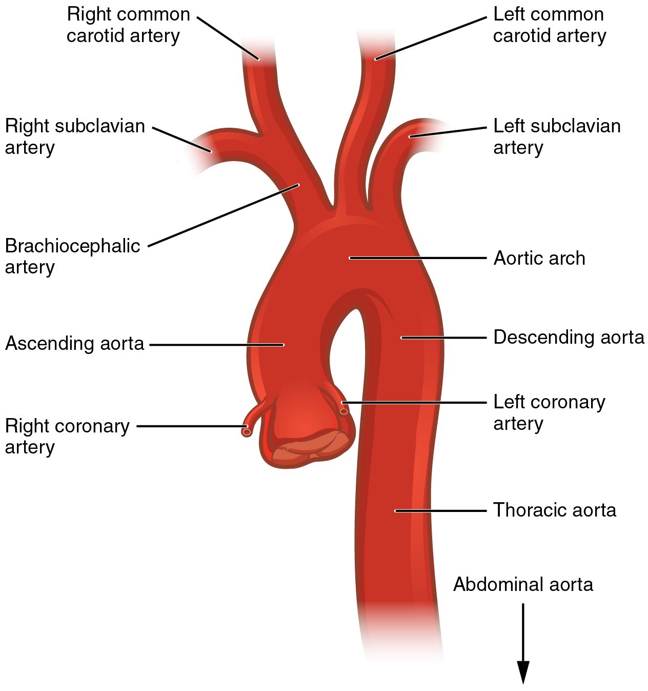 aortic dissection cross section