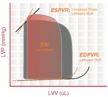 Pressure–Volume Loop Analysis In Cardiology