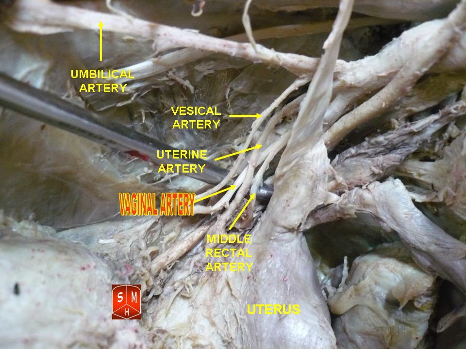 vaginal artery