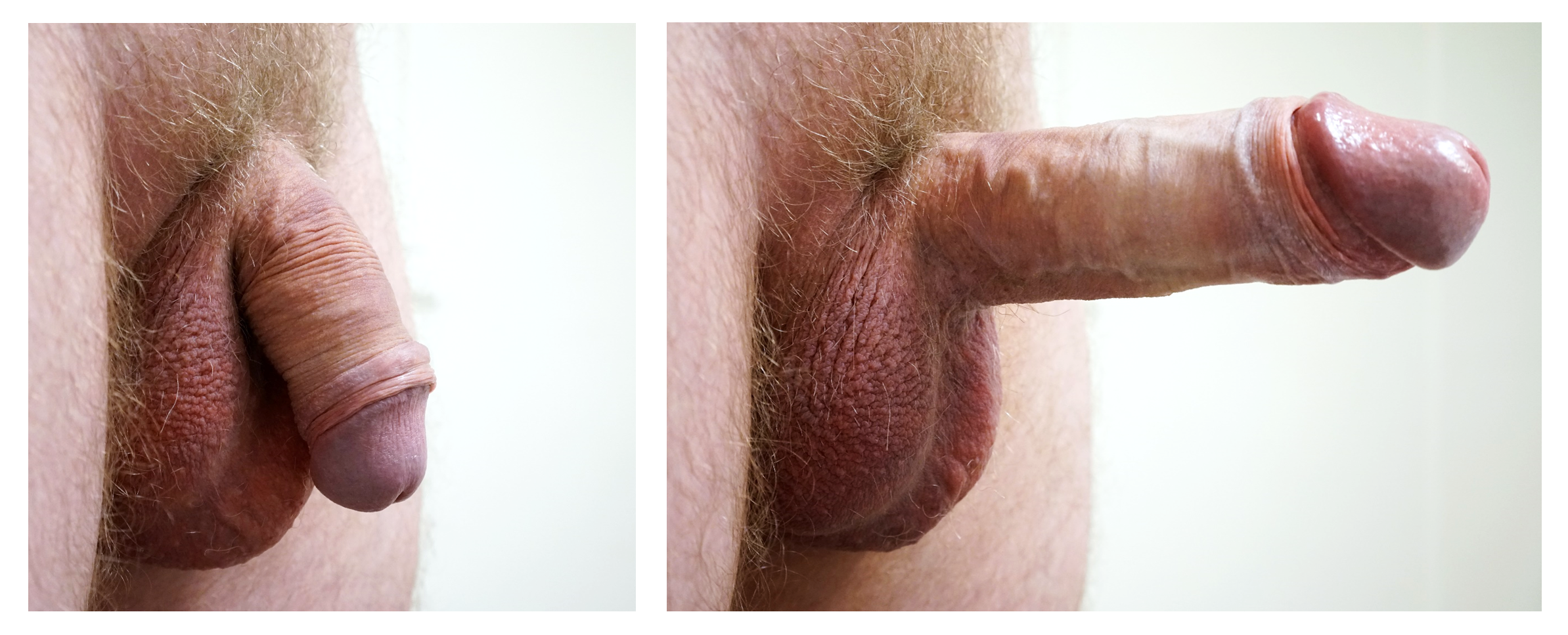 Small erect penis pic