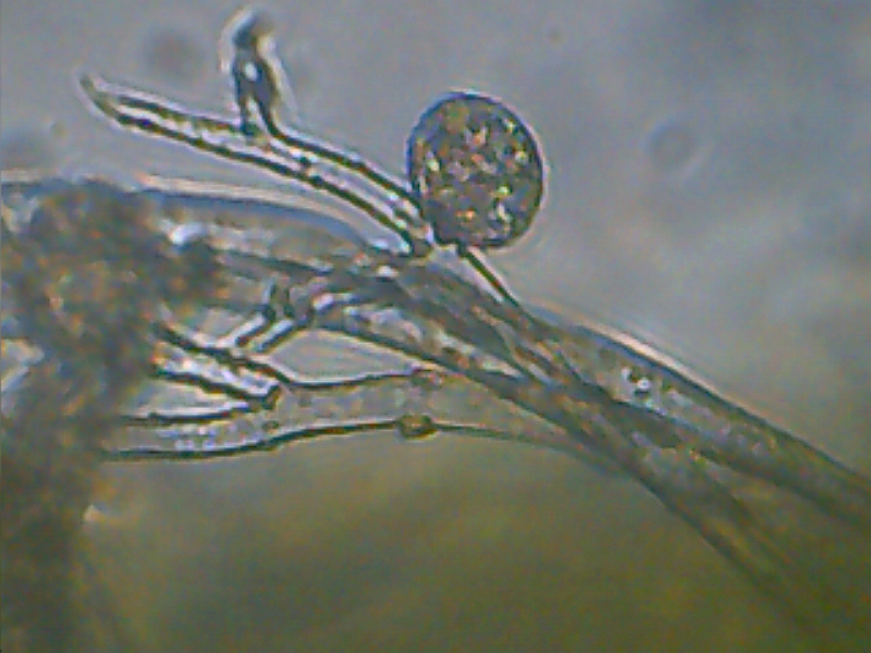 File:Pseudoperonospora farinosa f.sp. spinaciae at Spinacia oleracea sporangium (2).jpg