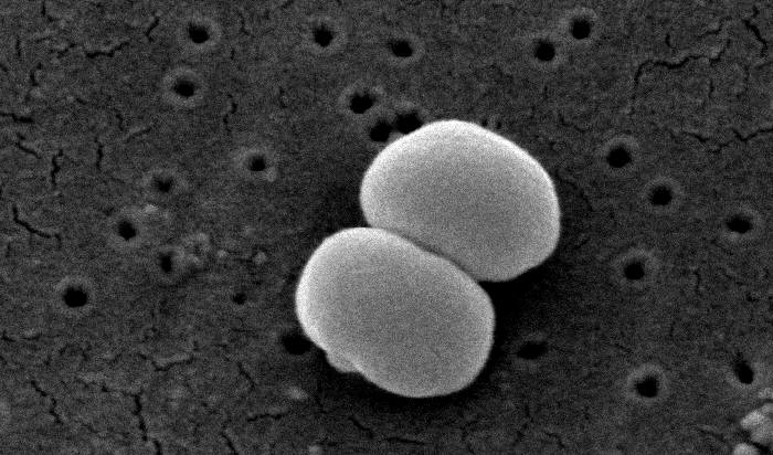 Staphylococcus aureus light microscopy. Morphology of