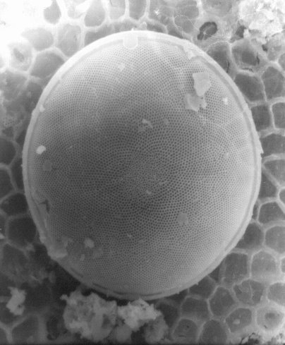 File:Centric diatom (3075277530).jpg