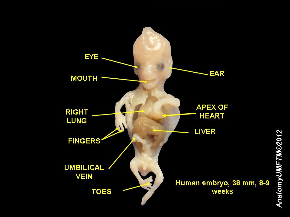 File:Human embryo 8  - Wikimedia Commons