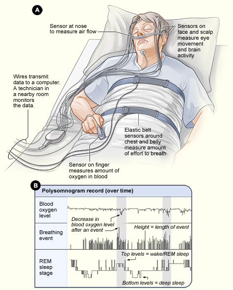 File:Sleep studies.jpg