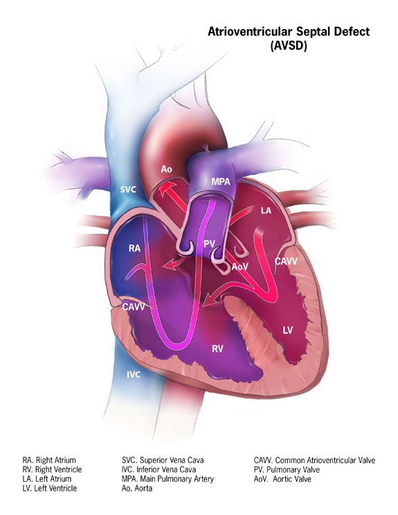 Septum Atrial