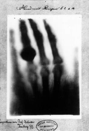 Hand mit Ringen (Hand with Rings): print of Wilhelm Röntgen's first "medical" X-ray, of his wife's hand, taken on 22 December 1895 and presented to Ludwig Zehnder of the Physik Institut, University of Freiburg, on 1 January 1896[22][23]