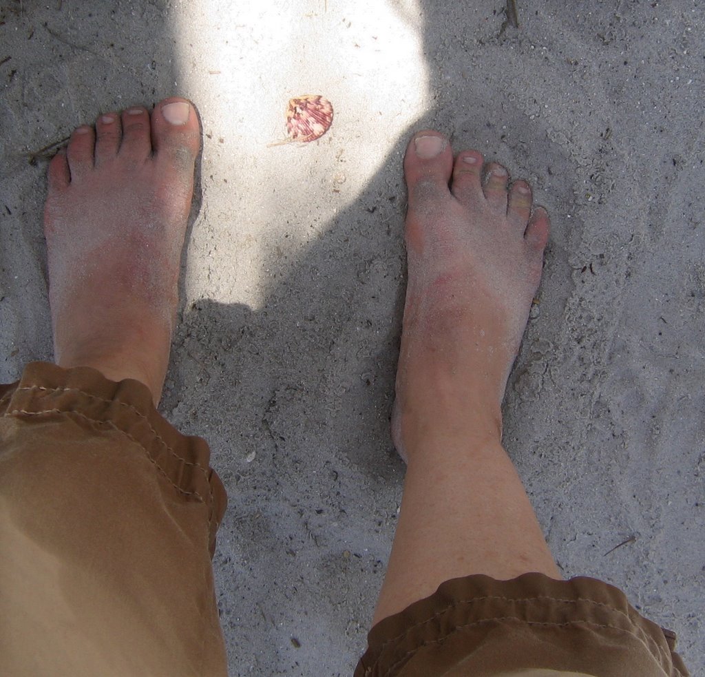 File:Soft bare soles.jpg - Wikipedia