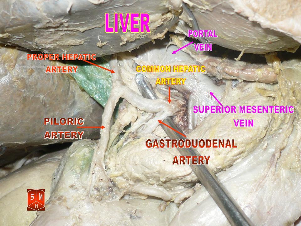 common hepatic artery