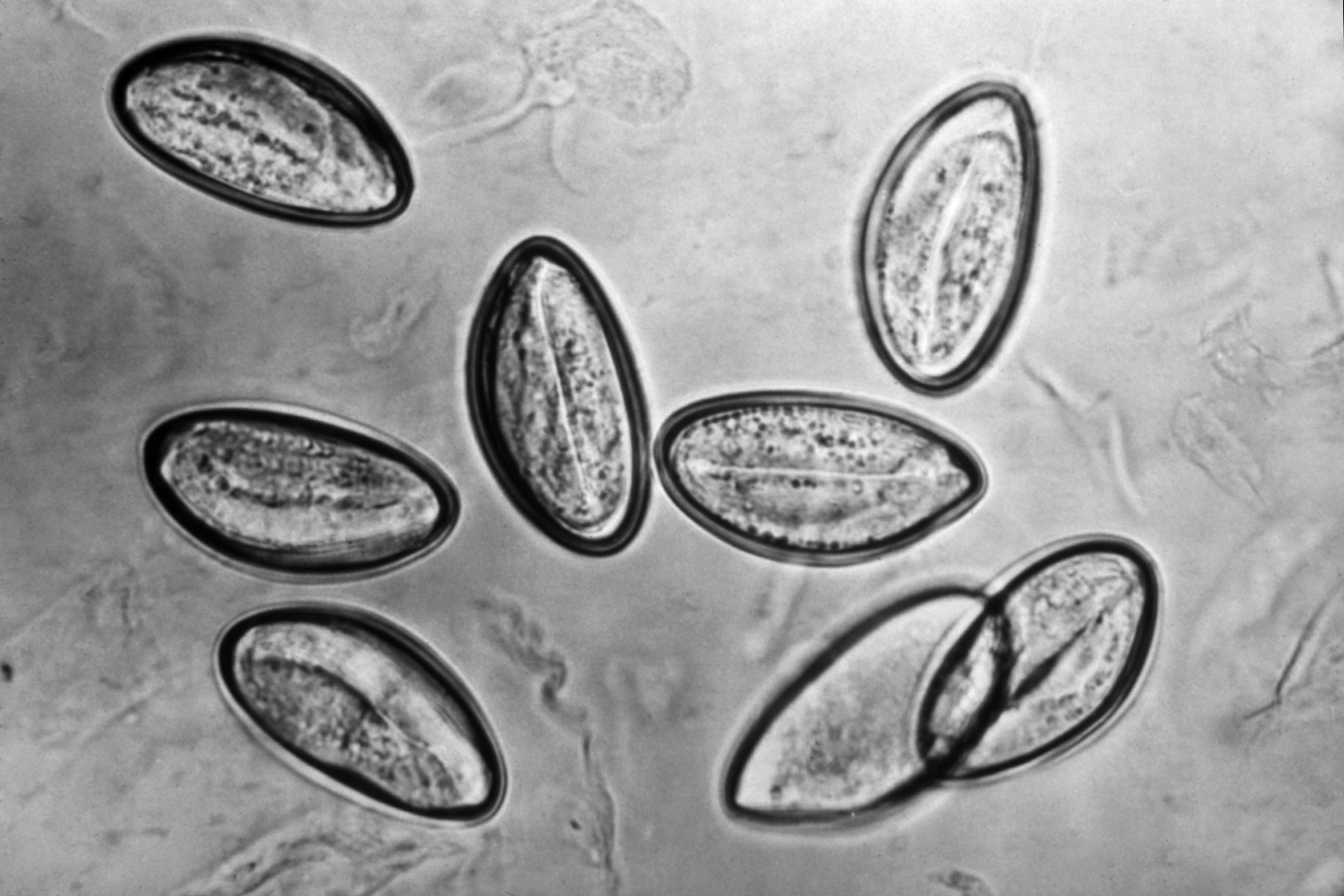 pinworms ultraibolya paraziták kiütés a lábakon