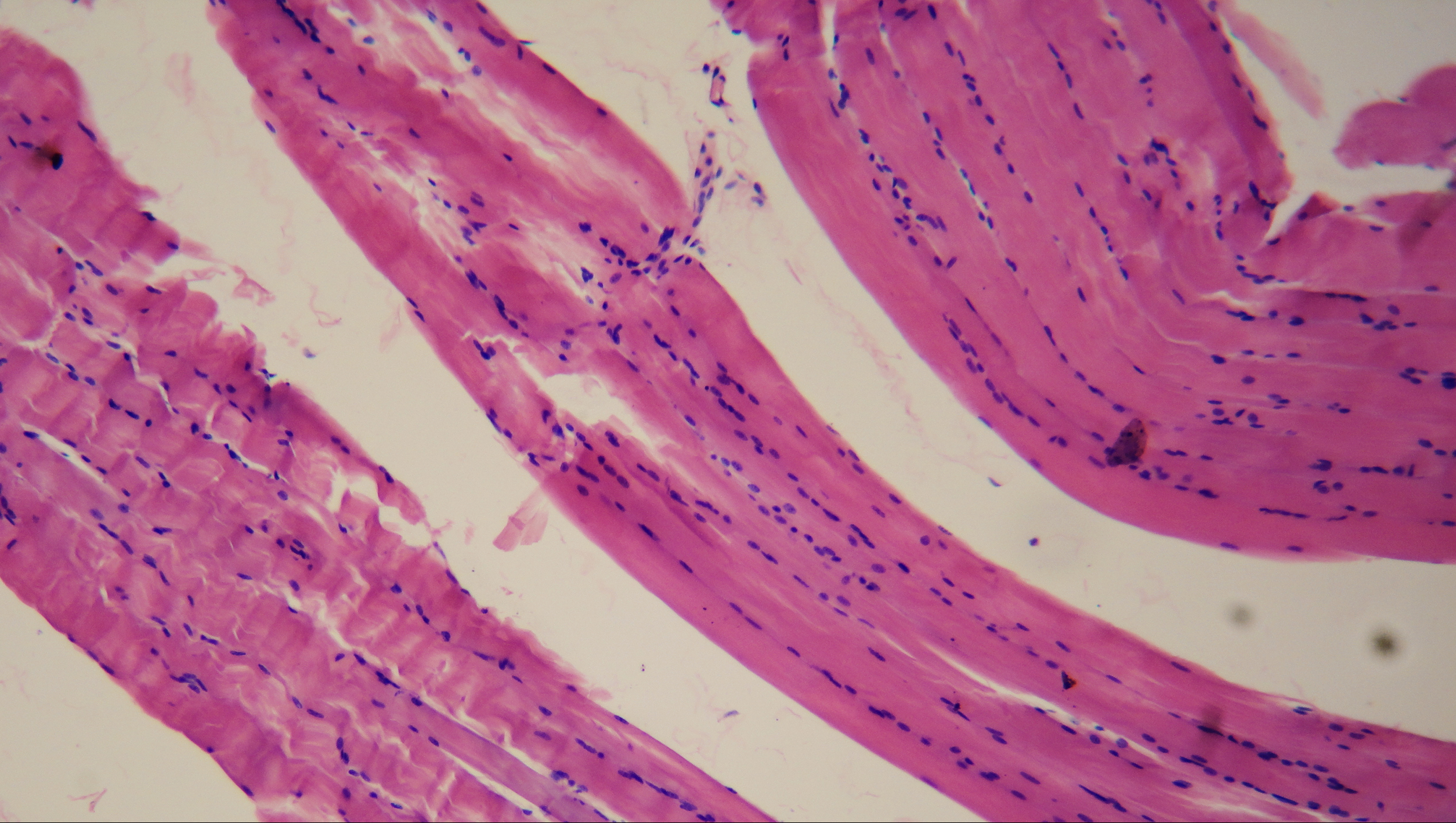 smooth muscle slide