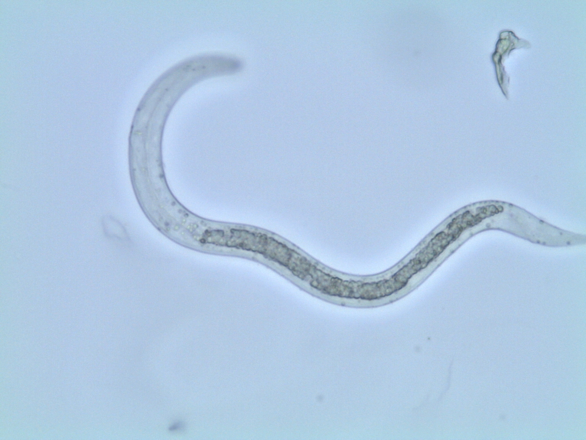 ascaris lumbricoides larvae