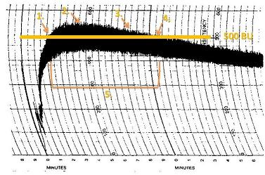 The graph is from a gluten rich bread flour, as its stability time is relatively long and the MTI is still above the 500 BU line. A weaker flour, such as a cake or pastry flour with a much lower gluten content would have a much steeper decline after peak time. Farinograph2.jpg