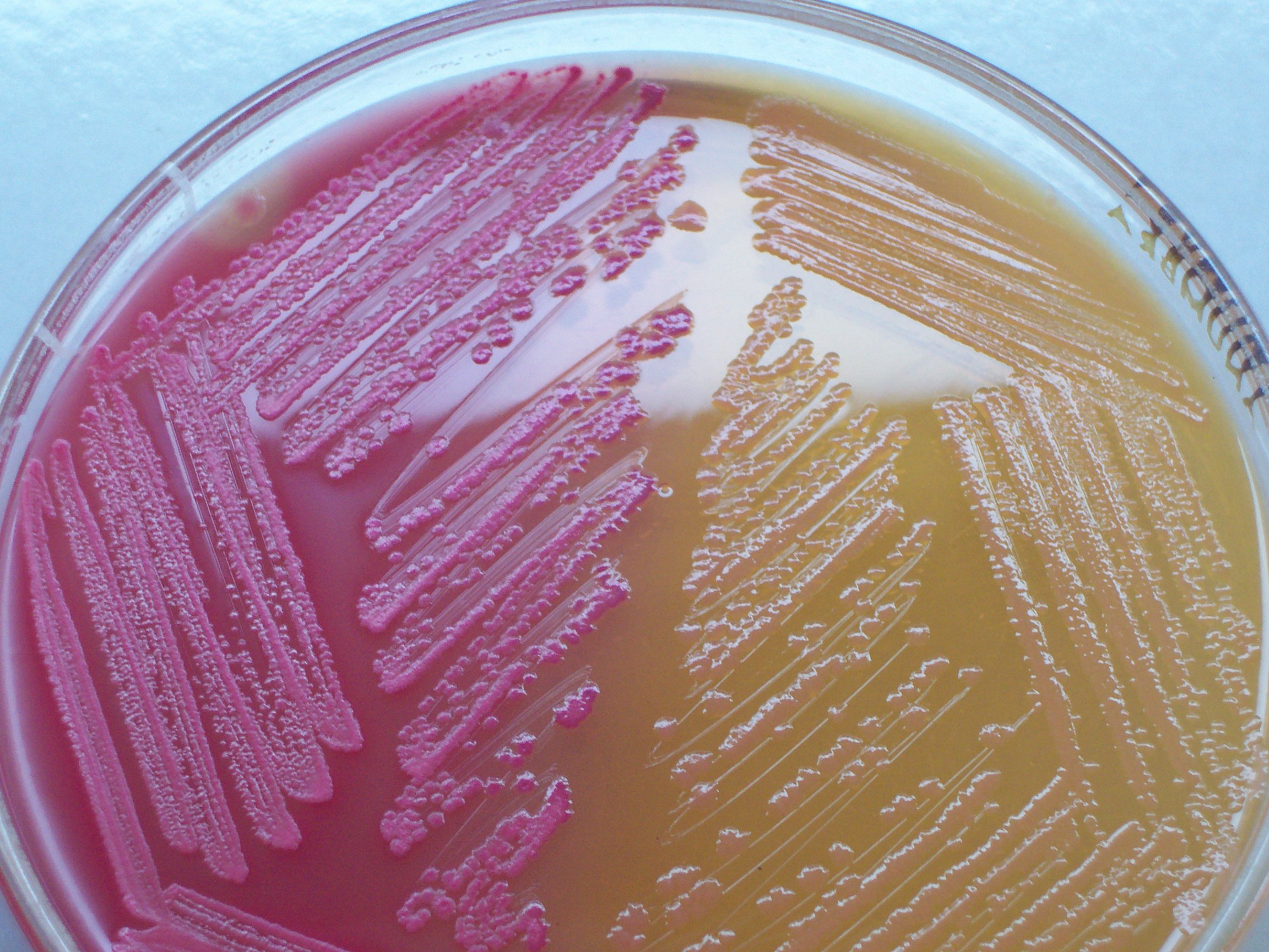 macconkey agar salmonella