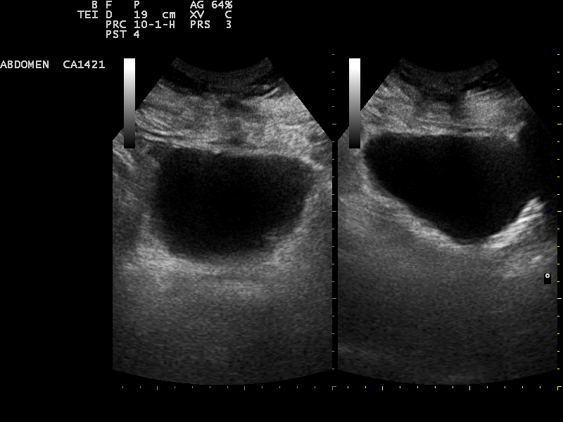 File:Ultrasound Scan ND 0104103659 1042320.png