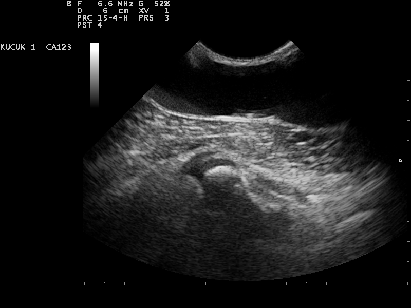 File:Ultrasound Scan ND 0125091859 0927560.png
