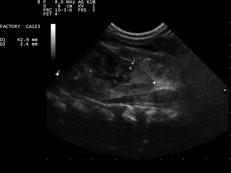 File:Ultrasound Scan ND 110131164227 1647440.jpg