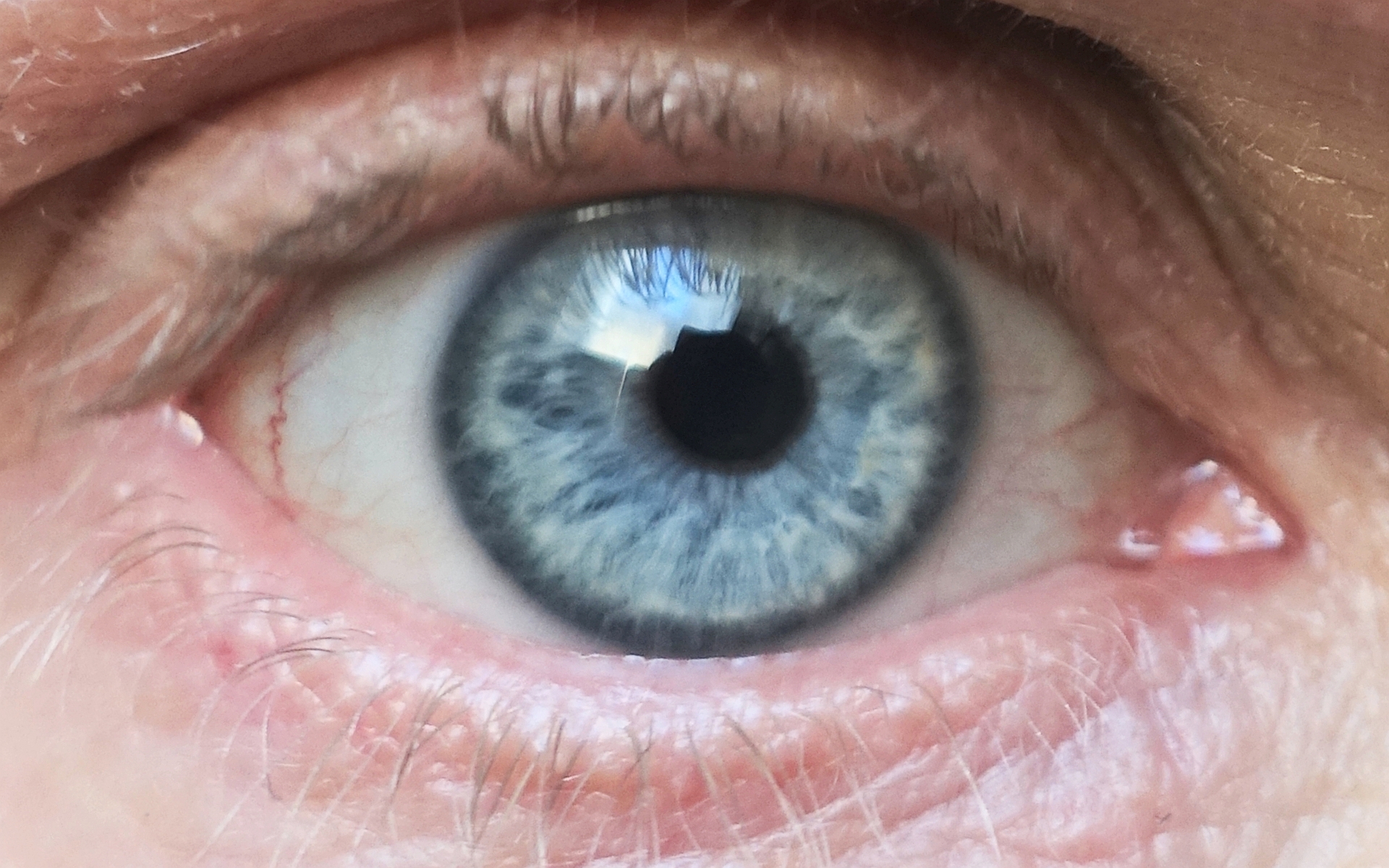 Main Iris Markings & Rings - Carahealth