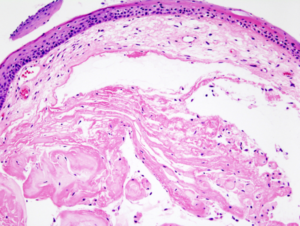 Nodulus vocalis – histological preparation