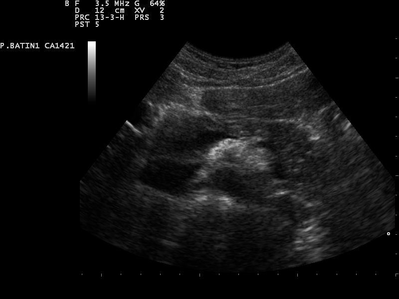 File:Ultrasound Scan ND 0119115951 1201090.png