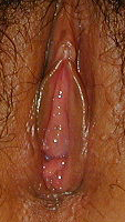 vaginal lubrication