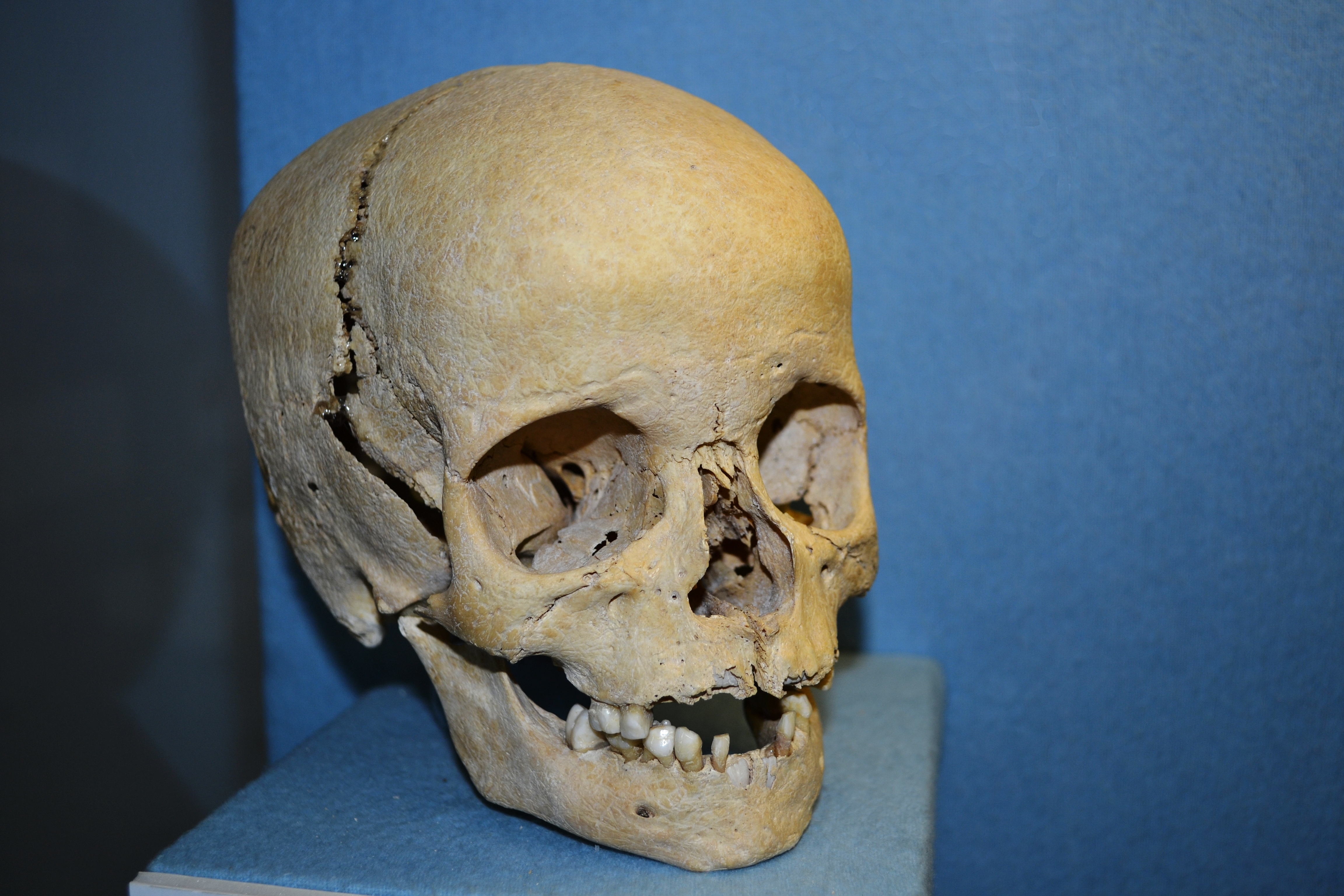 Anthroplogy - human skull of a boy.JPG