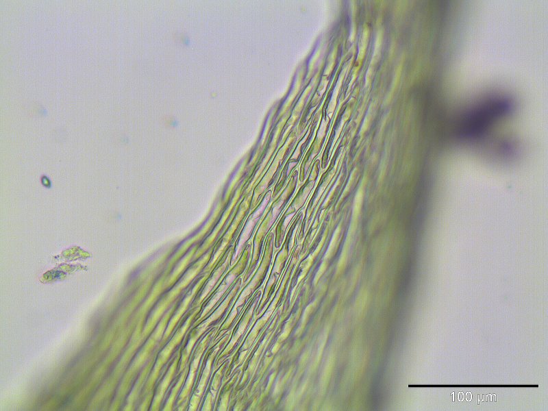File:Campylium stellatum blattspitze.jpeg