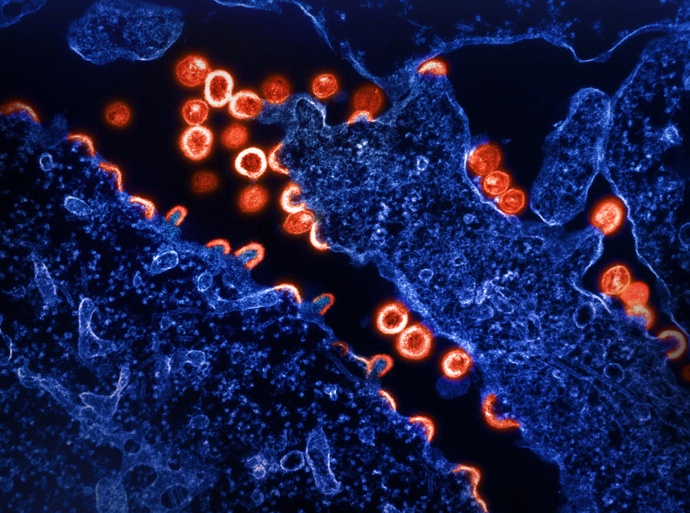 Антитела к human immunodeficiency virus. Геном человека. Стволовые клетки.